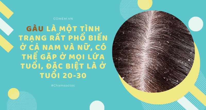 Nguyên nhân và cách khắc phục tình trạng làm tóc xong bị gàu  Nhà thuốc  FPT Long Châu