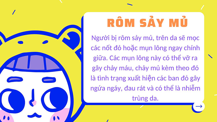 rom-say-mu-la-gi