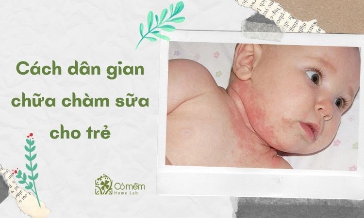 Cách dân gian chữa chàm sữa ở trẻ