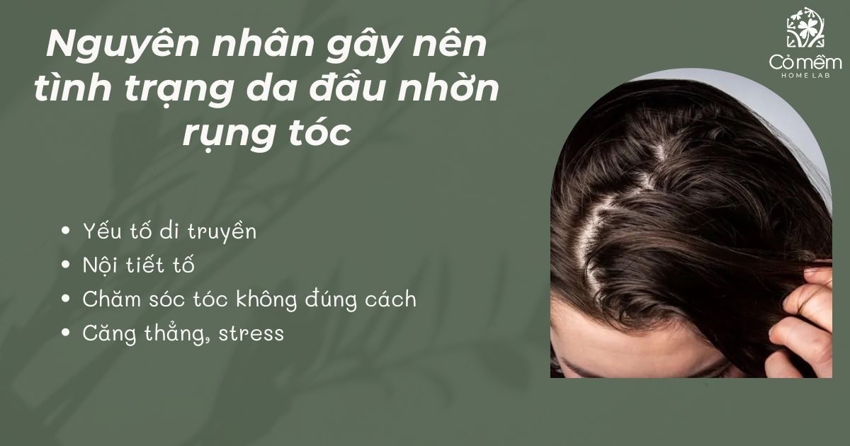 Da đầu nhờn rụng tóc