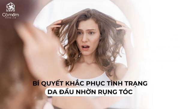 Da đầu nhờn rụng tóc