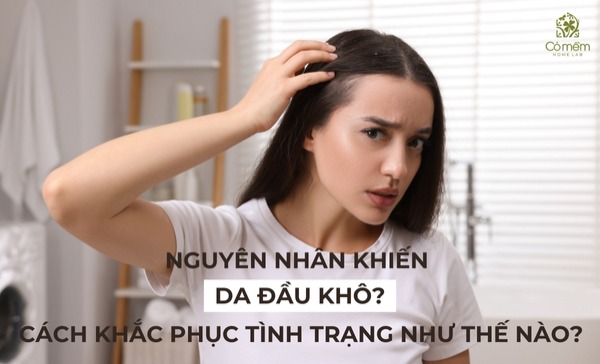 da đầu khô 