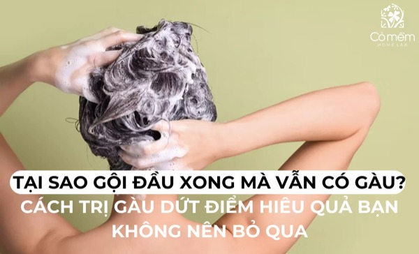 Tại sao gội đầu xong mà vẫn có gàu