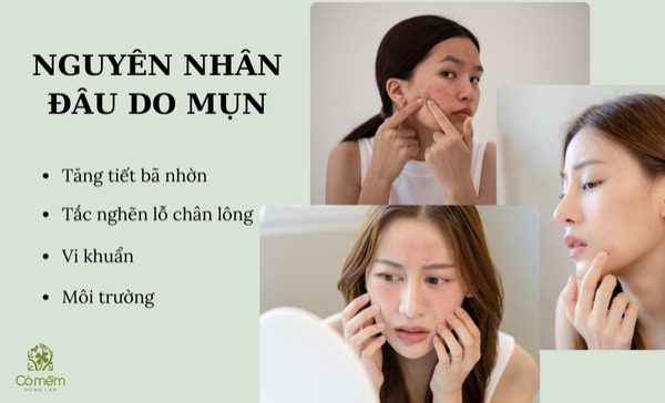 kem trị mụn giá học sinh