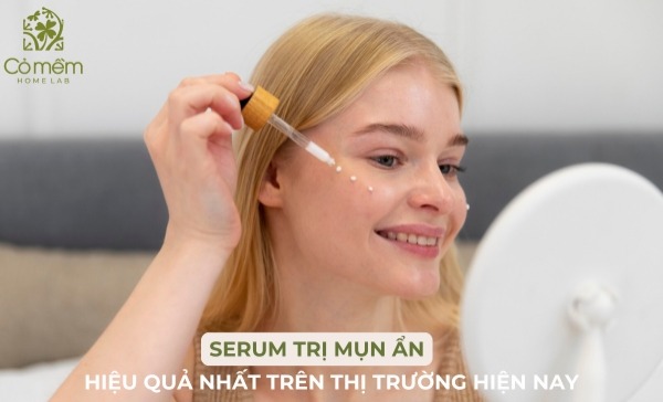 serum trị mụn ẩn