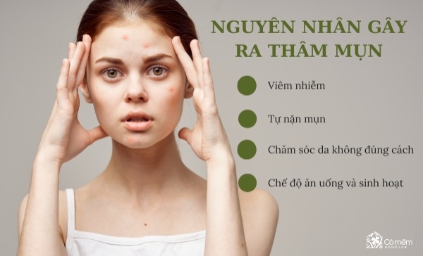 serum trị mụn thâm