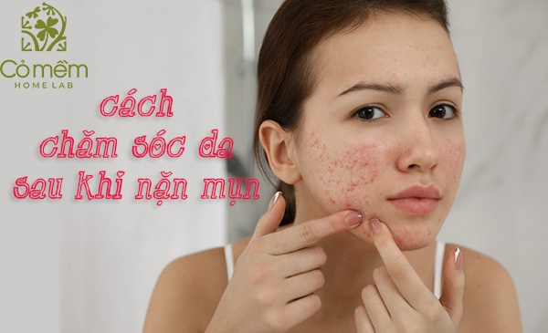 Có các sản phẩm skincare nào đặc biệt dành riêng cho da sau khi nặn mụn không?
