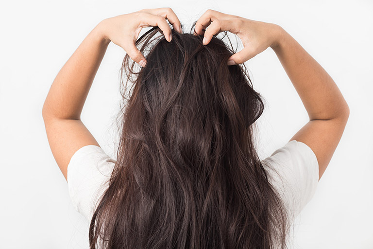 7 mẹo hay - Chấm dứt tình trạng ngứa da đầu và rụng tóc